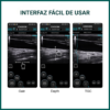 Ecógrafo SonoEye P7 SW VET