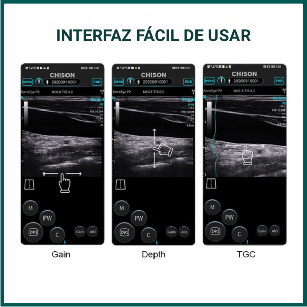 Ecógrafo SonoEye P7 SW VET