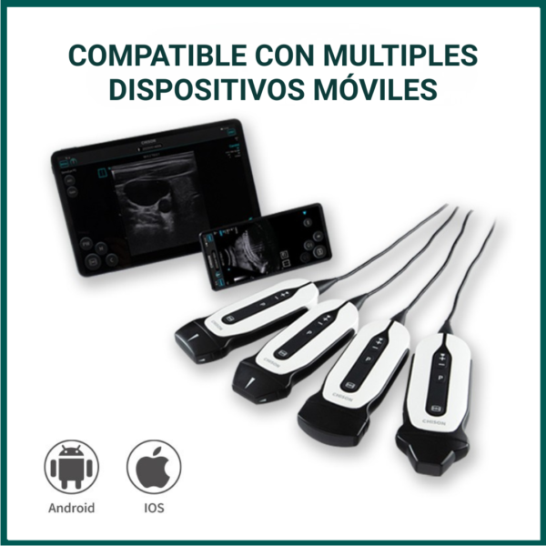 Ecógrafo Portátil SonoEye P7 VET
