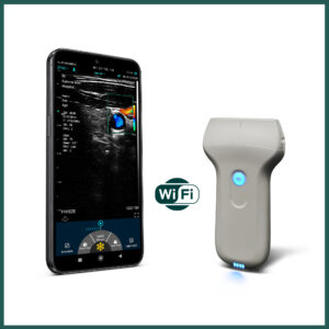 Ecógrafo de Mano Inalámbrico con Transductor Lineal Gelt G-W20P